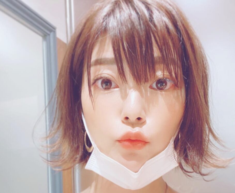 伊瀬茉莉也　整形